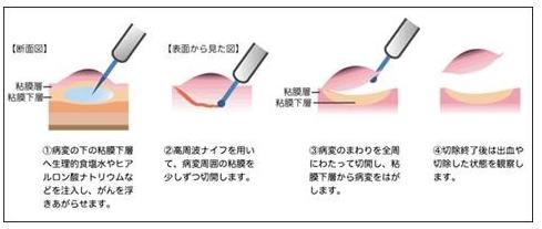 大圃研 ESD